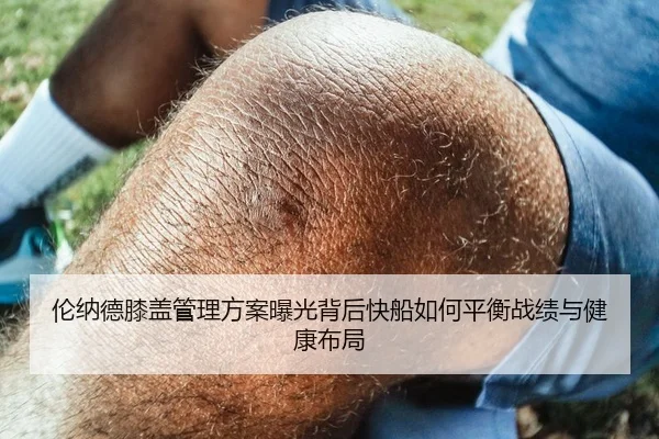 伦纳德膝盖管理方案曝光背后快船如何平衡战绩与健康布局